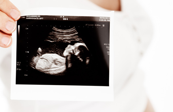 V Arkansase podpísali zákaz potratov rozkúskovaním tela dieťaťa