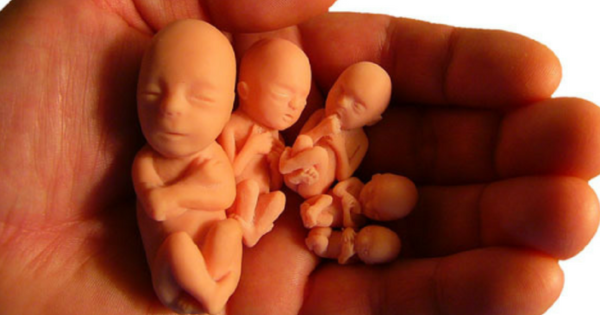 Reportáž CNN o írskom pro-choice hnutí priznáva, že potraty zabíjajú deti